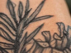 Schorf nach dem Stechen